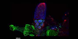 aurox confocal microscope Drosophila egg chamber.jpg